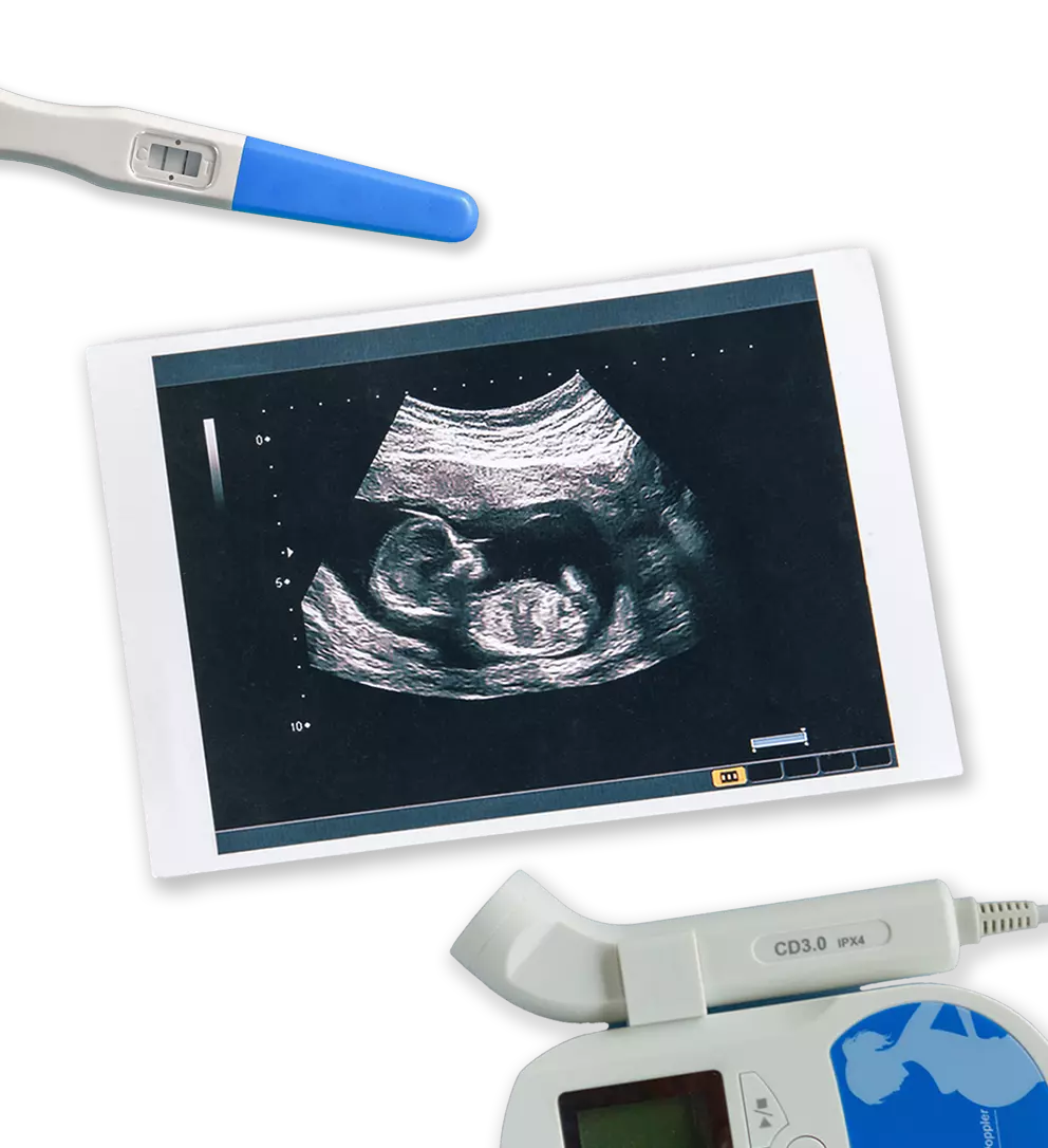 Ultrasound of a pregnancy and other equipment
